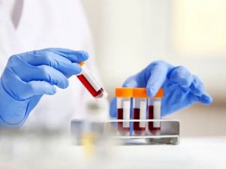 غربالگری کلسترول کودکان ضروری است؟