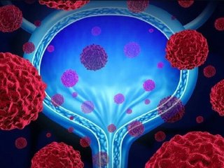 نقش مواد پروبیوتیک در عفونت‌های ادراری زنان