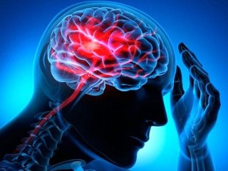 آمار سکته مغزی در ایران؛ بالاتر از میانگین جهانی؟