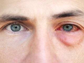علایم چشمی ناشی از کرونا را جدی بگیرید