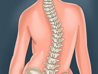 حرکات مضر برای مبتلایان به اسکولیوز: قبل از ورزش حتما بخوانید