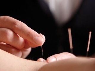 طب سوزنی خطر سکته مغزی را کاهش می‌دهد؟