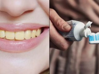 چرا دندان‌ها زشت می‌شود؟