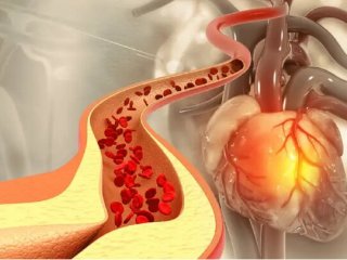عوامل بالا برنده کلسترول و تریگلیسیرید خون را بشناسیم
