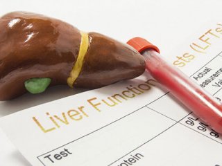علت بالا رفتن آنزیم‌های کبدی چیست؟