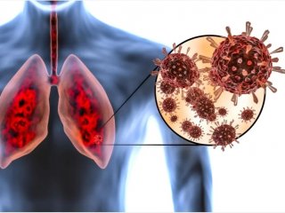 مهمترین نشانه ابتلا به کووید کدام است؟