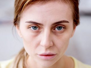 فاویسم چیست و چه علل و علائمی دارد؟