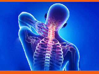 سندروم گردن پیامکی چیست؟