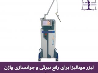 آیا رفع تیرگی ناحیه تناسلی به کمک لیزر برای بدن مضر است