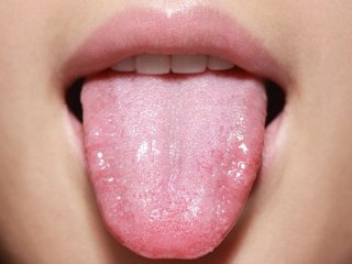 زبان سالم چه رنگی است و رنگ‌های مختلف نشانه کدام بیماری‌هاست؟ (+عکس)