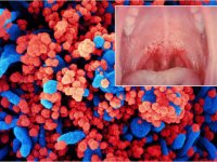 کروناویروس از طریق بزاق دهان هم منتقل می شود