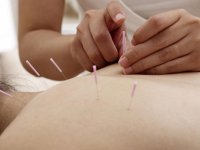 تفاوت‌های طب سوزنی با طب مدرن- قسمت اول