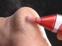 پینه و راه‌های مقابله با آن