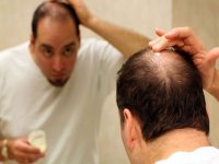 با  ریزش مو چه كنیم؟