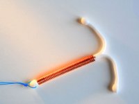 از IUD ميرِنا چه مي‌دانيم؟