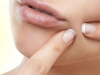 چگونه از خارش جوش های خود رها شویم؟ (1)