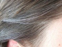 دلایل تغذیه‌ای سفید شدن مو (1)