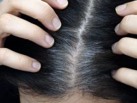 دلایل تغذیه‌ای سفید شدن مو (2)