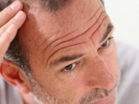 آیا استرس موها را سفید می‌کند؟