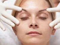 جوان‌سازی چشم با جراحي پلاستيك و زيبايي پلك