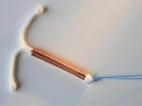 همه‌چيز درباره IUD