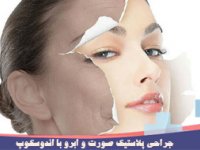 جراحی پلاستیک صورت و ابرو با اندوسکوپ