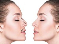 جراحی زیبایی بینی و سال نو