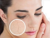 اثرات آلودگی هوا بر پوست
