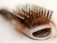 پيشگيری از چاقی، مبارزه با ريزش مو