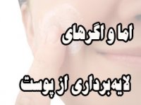 اما و اگر‌های لايه‌برداری از پوست