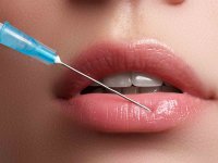 حقایقی ناگفته در مورد تزریق ژل لب!