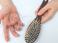 بیش از نیمی از ایرانیان موهای ناسالمی دارند