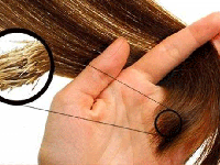 چگونه از موخوره جلوگیری کنیم؟