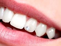 خطرات کاشت نگین روی لب‌ها، بینی، گوش، چشم و دندان