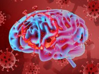 بروز احتمالی زوال حافظه و عقل در بیماران کووید ۱۹