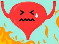 درمان مشکلات متداول ادراری  ؛ سوزش و تکرر ادرار