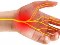 سندروم تونل کارپال ؛ از تشخیص تا راه های درمان