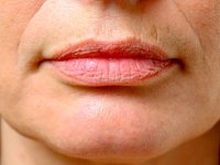 پیشگیری از چروک شدن دور لب با چند راهکار ساده