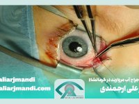 معرفی بهترین جراح آب مروارید در کرمانشاه | دکتر علی ارجمندی