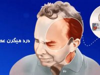 درمان میگرن عصبی