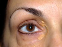 ۸ علامت بیرونی بدن که نشان می‌دهند مشکل جدی سلامتی دارید