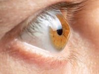 عامل مهم قوز قرنیه؛ این کار را نکنید