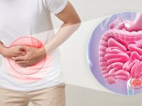 خاصیت معجزه‌آسای این میوه برای درمان یبوست