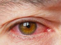 چه غذاهایی فشار چشم را بالا میبرد؟