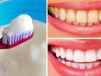 روش‌های طبیعی سفید کردن دندان‌ها