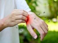 دارندگان این گروه خونی برای پشه‌ها جذاب‌ترند