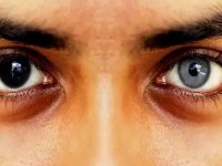 تغییر رنگ چشم ؛ یک جراحی زیبایی پرطرفدار