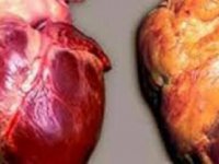 ۴ علامت خاموش که می‌توانند سکته قلبی را سال‌ها زودتر به سراغتان بیاورند