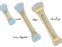 عمر کوتاه استخوانهای ایرانی + اینفوگرافی