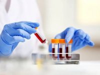 غربالگری کلسترول کودکان ضروری است؟